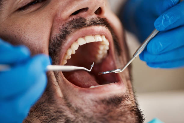 Best Walk-In Emergency Dentist in Woodland Beach, MI